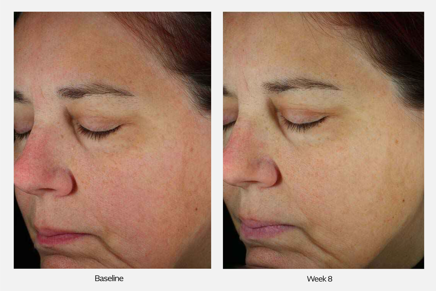 ZO Skin Health Next-Generation Daily Power Defense